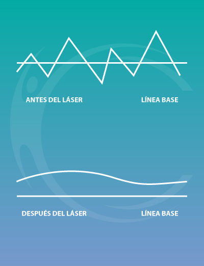 tratamiento laser con Bodycare Center