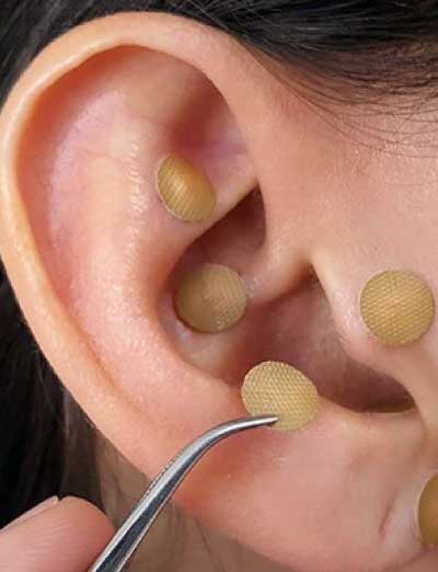 Tratamientos para eliminar el estrés sin ningún tipo de dolor con Bodycare Center