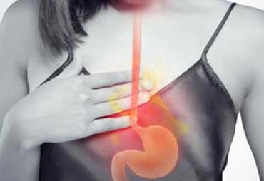 Tratamiento de reflujo gastroesofágico