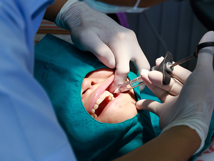 CIRUGÍA DENTAL