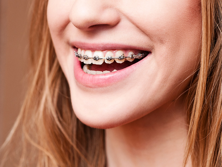 Servicios de ortodoncia