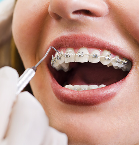 PAQUETES DE ORTODONCIA