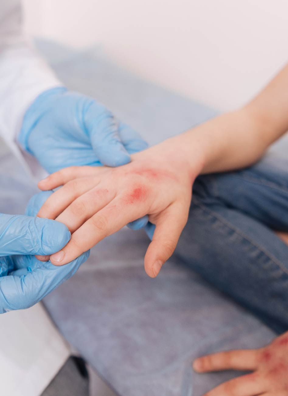 Alergología Pediátrica