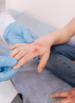 Alergología Pediátrica