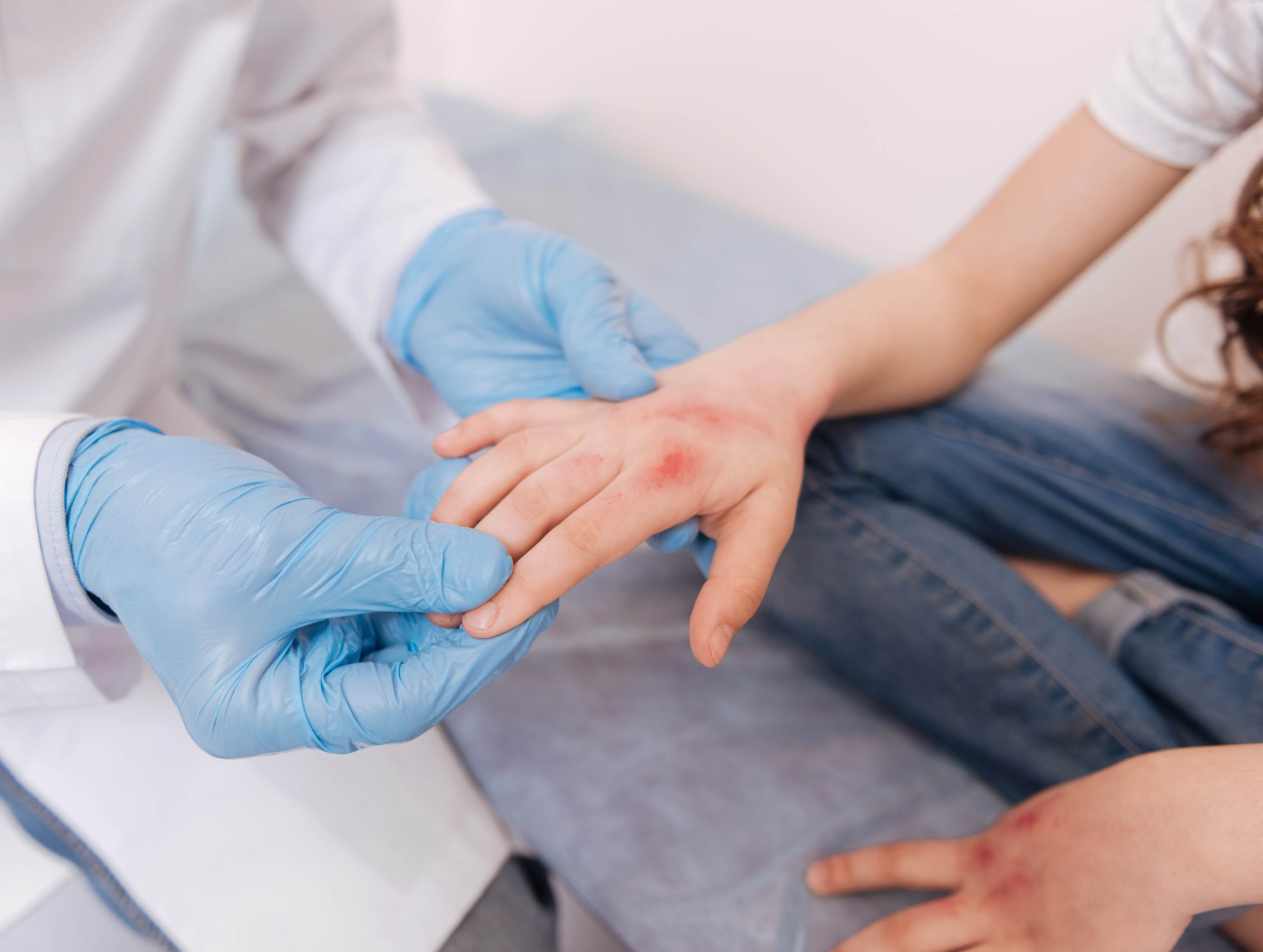 ESPECIALISTAS EN ALERGOLOGÍA PEDIATRICA