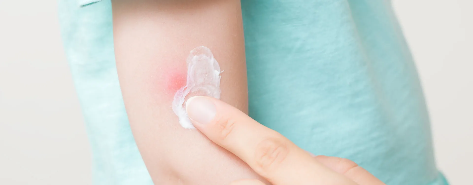 Dermatologa pediatra cdmx