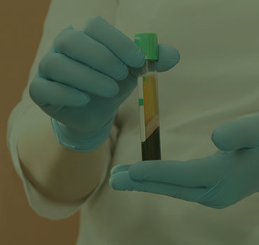 AUTOVACUNA DE PLASMA RICO EN PLAQUETAS